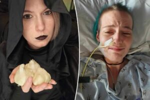 Leia mais sobre o artigo I have the same rare ‘vampiric’ condition as Dracula – garlic can kill me