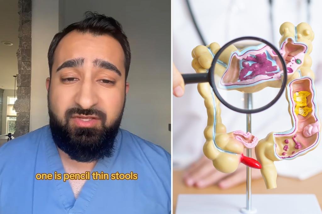 Leia mais sobre o artigo The doctor reveals 5 symptoms that could mean colon cancer