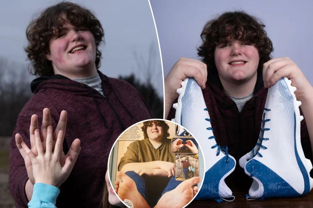 Leia mais sobre o artigo Teen sets world record for biggest feet and hands: ‘People are usually surprised’